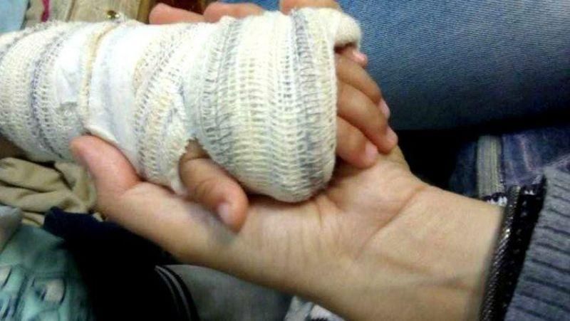 Pais são presos após criança de três anos ser socorrida com o braço fraturado Pais são presos após criança de três anos ser socorrida com o braço fraturado