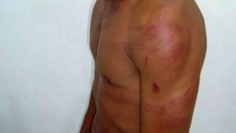 Ex-mulher invade casa de ex-marido e o agride em Porto Velho Ex-mulher invade casa de ex-marido e o agride em Porto Velho