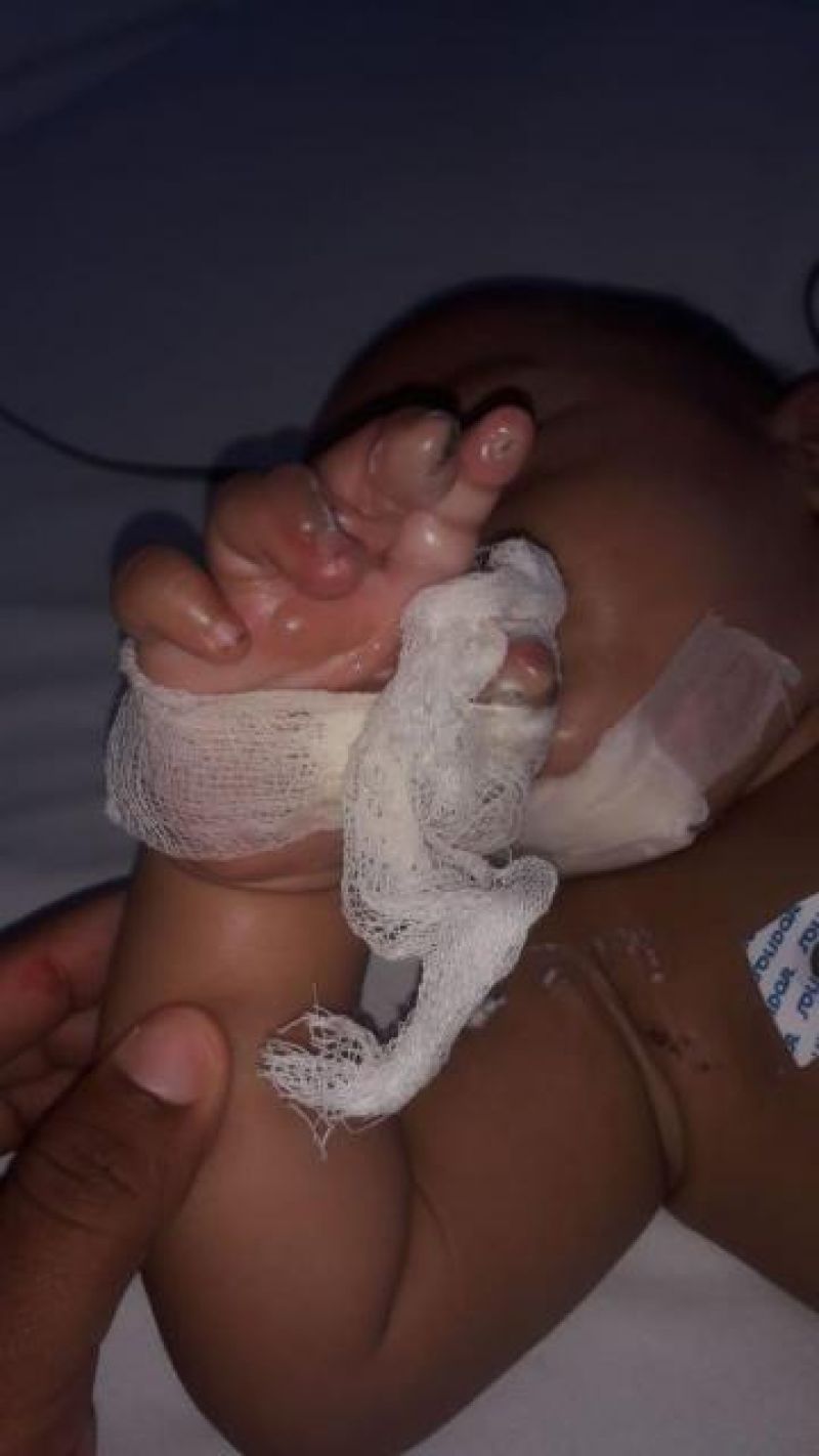 Bebê leva choque e desmaia após colocar carregador de celular na boca Bebê leva choque e desmaia após colocar carregador de celular na boca