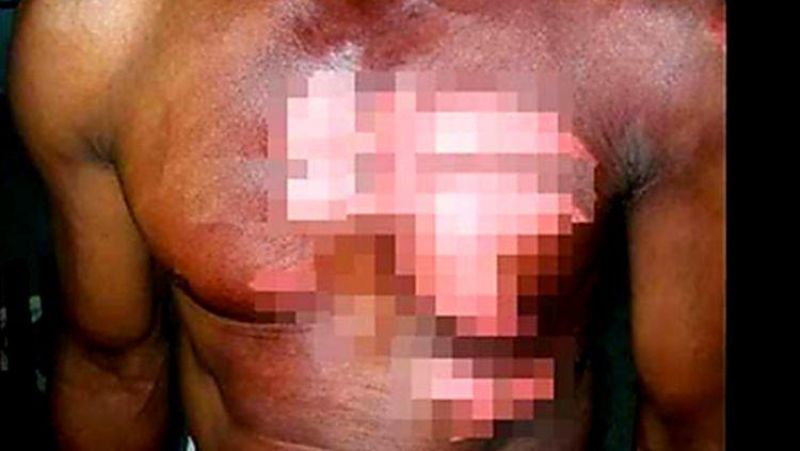 Após ler mensagens em celular, mulher ataca marido com água fervente