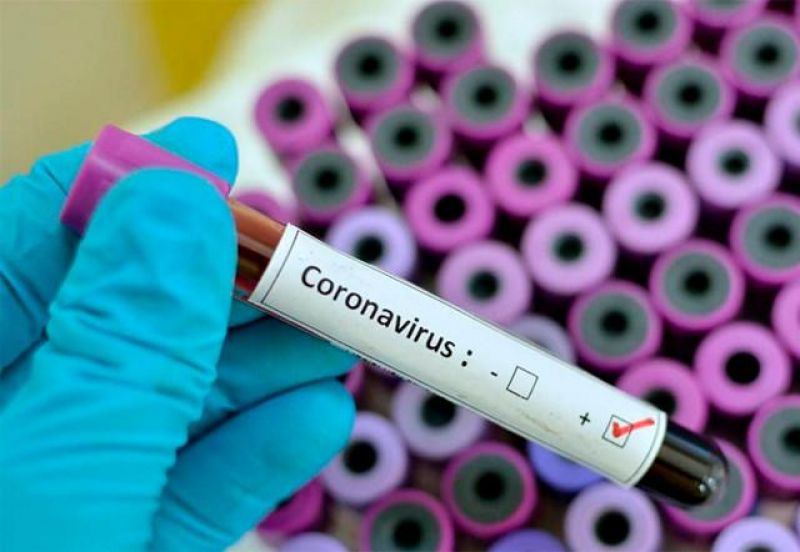 Sesau/RO confirma primeira suspeita de coronavírus em Porto Velho; Brasil tem 2 casos confirmados