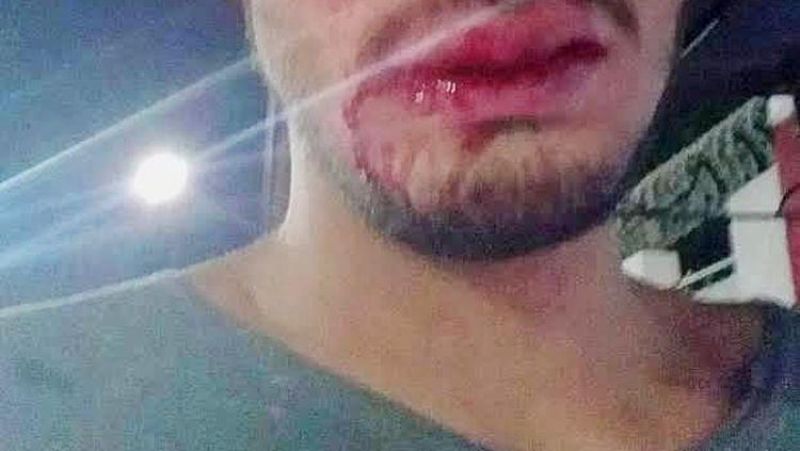 Recepcionista é agredido por oito venezuelanos em hotel de Porto Velho Recepcionista é agredido por oito venezuelanos em hotel de Porto Velho