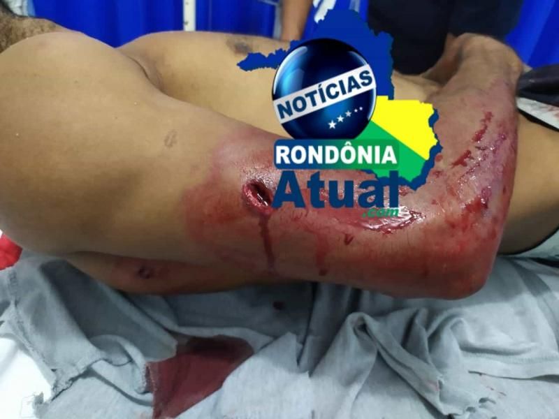 Homem é baleado em tentativa de homicídio em Ji-Paraná Homem é baleado em tentativa de homicídio em Ji-Paraná