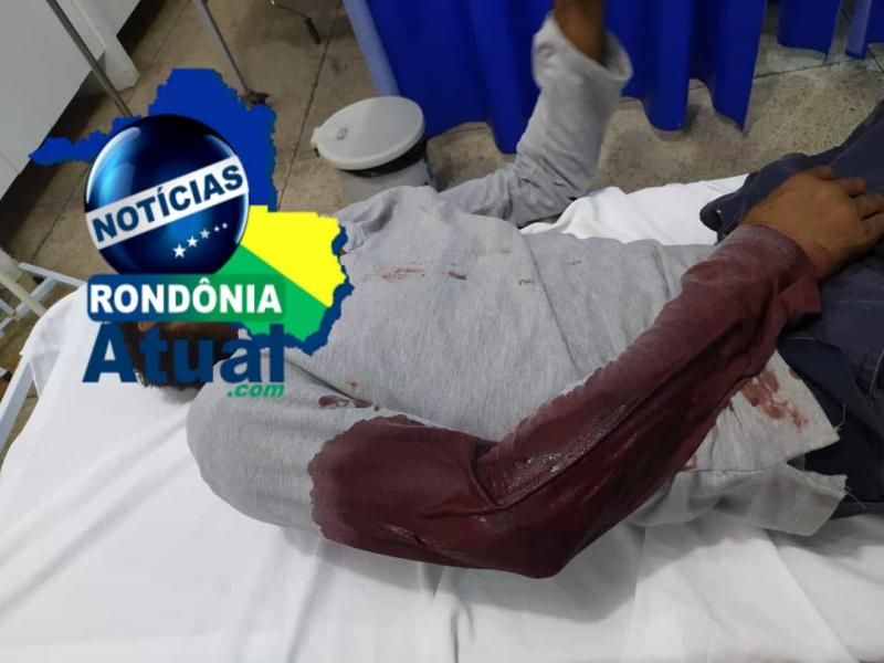 Homem é baleado em tentativa de homicídio em Ji-Paraná Homem é baleado em tentativa de homicídio em Ji-Paraná