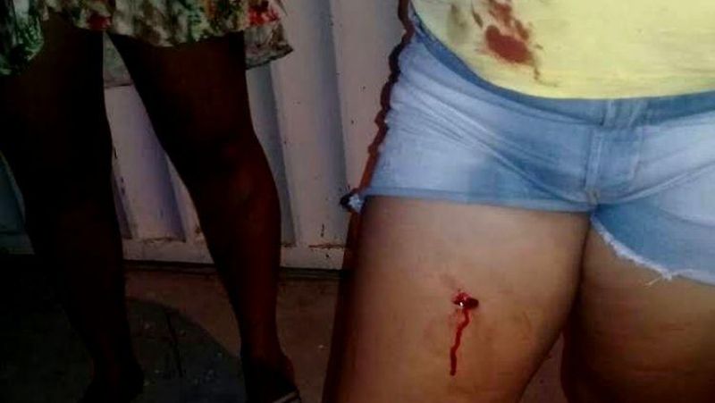 Mulher é atacada a facadas e mordidas pelo marido em Porto Velho