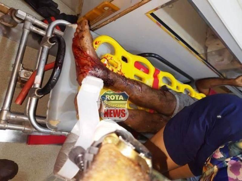 Colisão entre duas carretas na BR-364 deixa motorista com fratura exposta na perna, em Vilhena Colisão entre duas carretas na BR-364 deixa motorista com fratura exposta na perna, em Vilhena