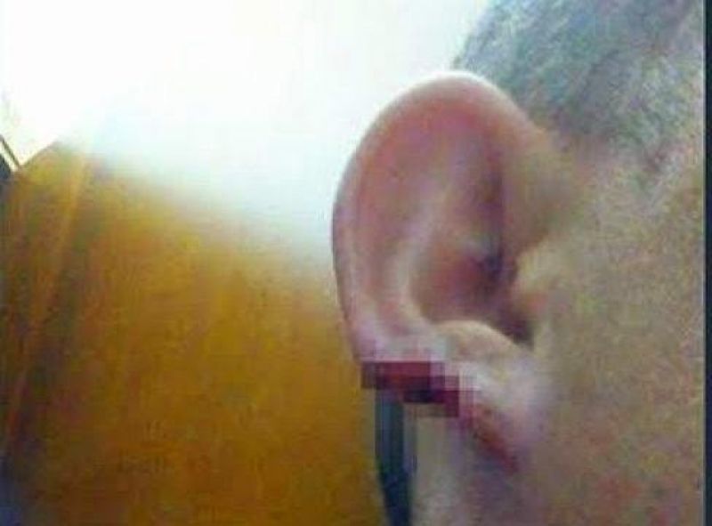 Homem arranca pedaço do nariz e orelha do namorado de sua ex