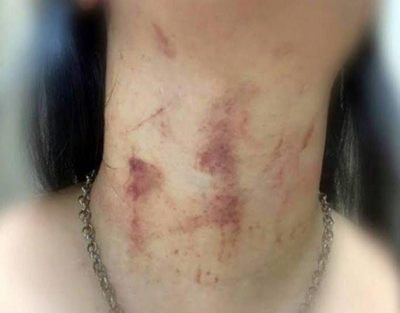 Após comemorar o Dia dos Namorados, marido tenta matar mulher enforcada Após comemorar o Dia dos Namorados, marido tenta matar mulher enforcada