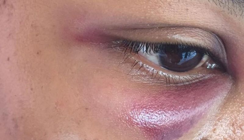 Mulher é espancada pelo ex-cunhado ao tentar defender a irmã de agressão Mulher é espancada pelo ex-cunhado ao tentar defender a irmã de agressão