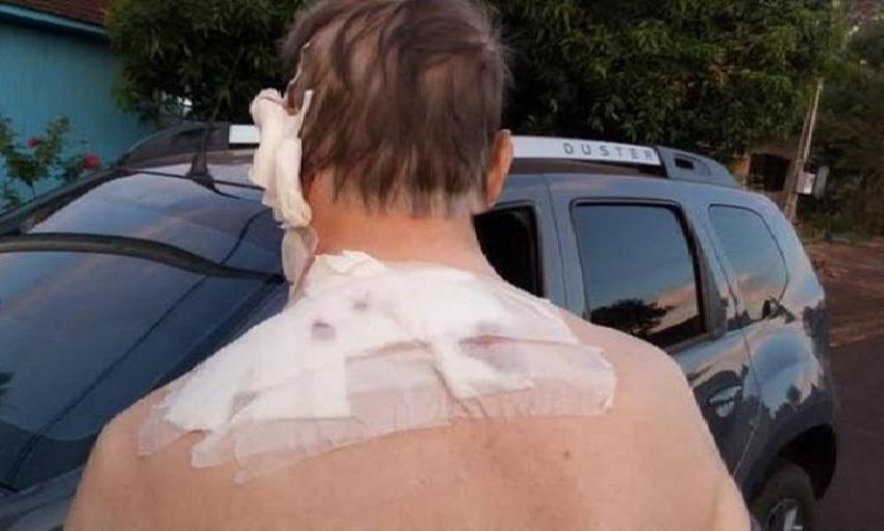 Idoso é atacado com golpes de pá na cabeça durante discussão com o vizinho
