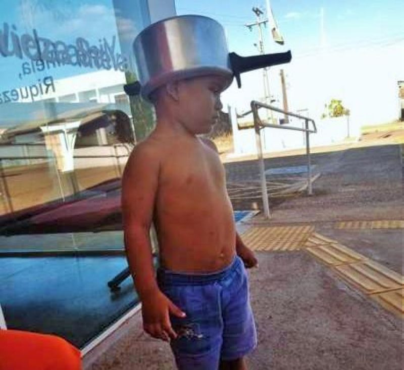 Criança de 03 anos prende panela de pressão na cabeça e é socorrido por Bombeiros em Vilhena Criança de 03 anos prende panela de pressão na cabeça e é socorrido por Bombeiros em Vilhena