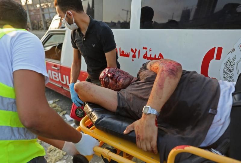 Vídeos impressionantes: Explosão devasta região portuária no Líbano Vídeos impressionantes: Explosão devasta região portuária no Líbano