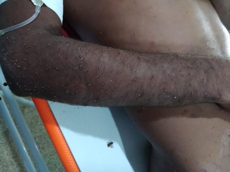Homem é atendido em estado grave após levar mais 2 mil ferroadas de abelha em Ariquemes Homem é atendido em estado grave após levar mais 2 mil ferroadas de abelha em Ariquemes