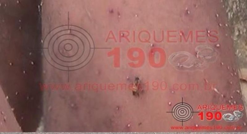 Homem é atendido em estado grave após levar mais 2 mil ferroadas de abelha em Ariquemes Homem é atendido em estado grave após levar mais 2 mil ferroadas de abelha em Ariquemes