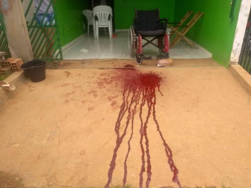 Cadeirante sofre tentativa de homicídio com tiro no rosto em Vilhena