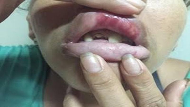 Irmã pede que irmão pare de beber e acaba agredida a socos Irmã pede que irmão pare de beber e acaba agredida a socos