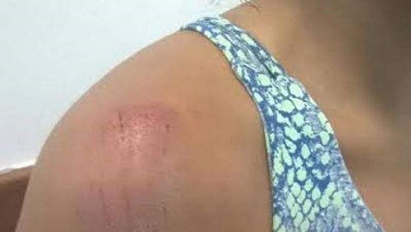 Jovem é espancada a capacetadas pelo cunhado dentro de casa Jovem é espancada a capacetadas pelo cunhado dentro de casa