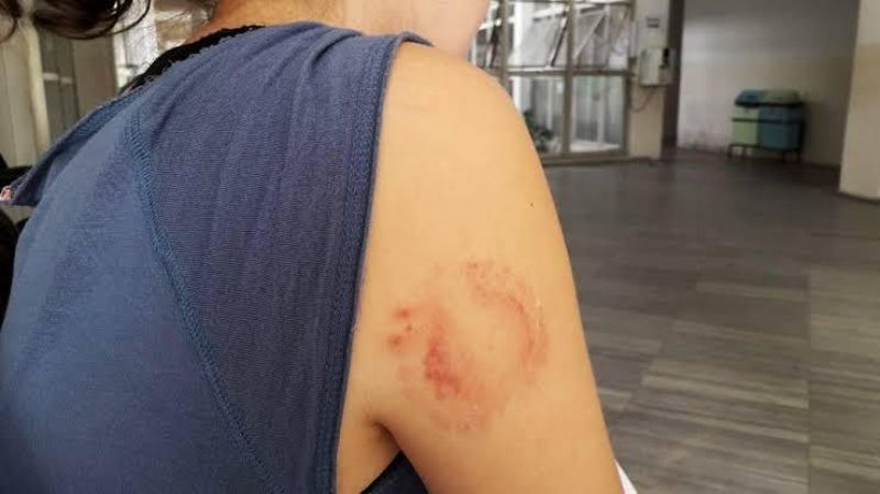 Cabo da PM é detido por agredir mulher com socos e mordidas, mas acaba solto por Cabo da PM é detido por agredir mulher com socos e mordidas, mas acaba solto por