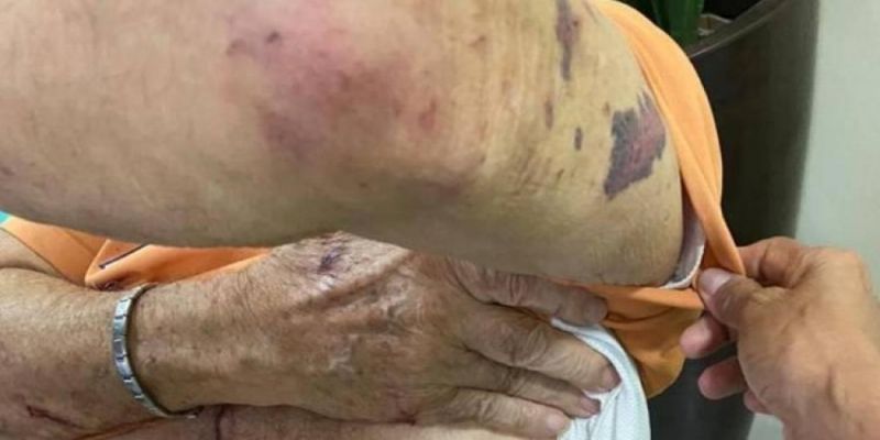 Idoso é violentamente espancado durante assalto na zona rural de Vilhena Idoso é violentamente espancado durante assalto na zona rural de Vilhena