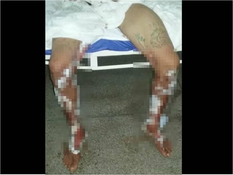 Por causa de dívida, traficantes jogam gasolina e ateiam fogo em Por causa de dívida, traficantes jogam gasolina e ateiam fogo em
