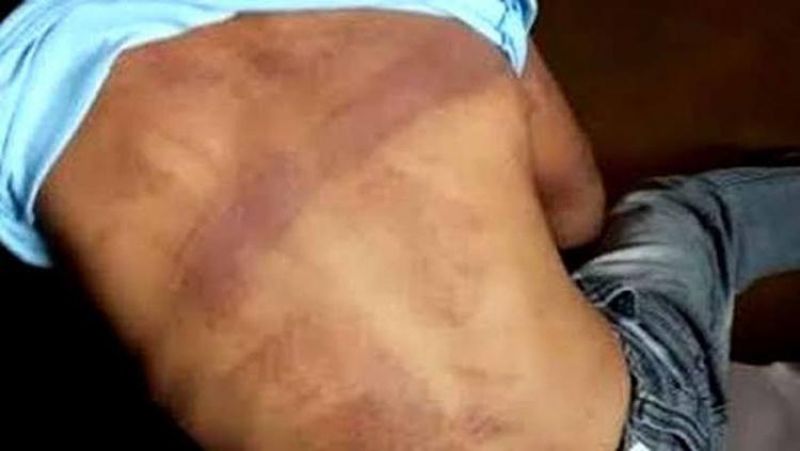 Pai denuncia e mãe é presa acusada de espancar o filho Pai denuncia e mãe é presa acusada de espancar o filho