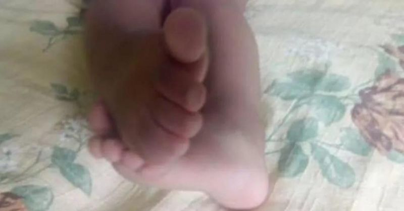 Mãe aciona a PM após bebê ser internada com suspeitas de estupro Mãe aciona a PM após bebê ser internada com suspeitas de estupro