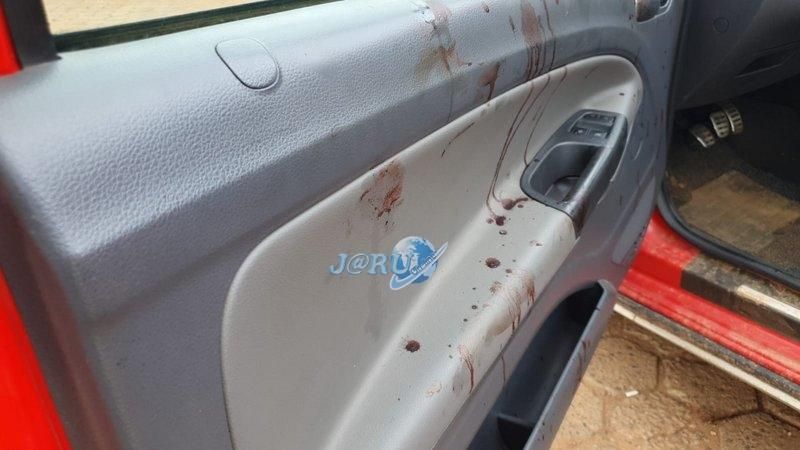 Homem é baleado no pescoço e mão após ser perseguido por assassino em Jaru Homem é baleado no pescoço e mão após ser perseguido por assassino em Jaru