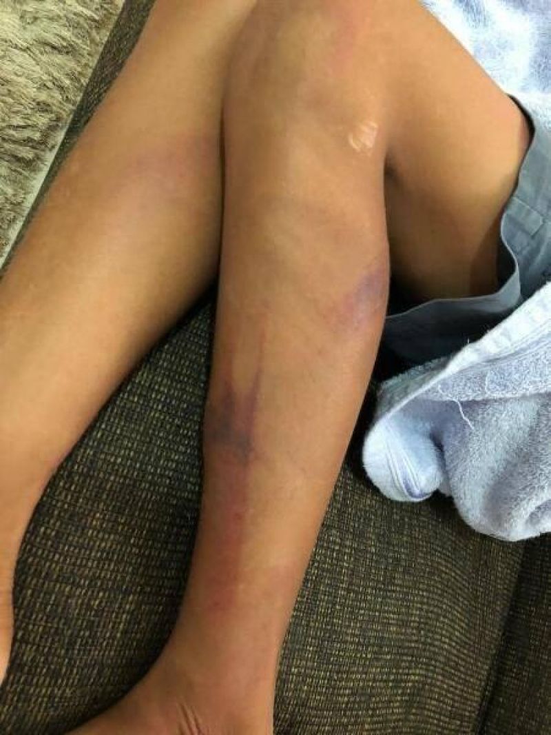 Homem espanca filho de 11 anos por não fazer almoço, aponta arma falsa para policiais e acaba morto Homem espanca filho de 11 anos por não fazer almoço, aponta arma falsa para policiais e acaba morto