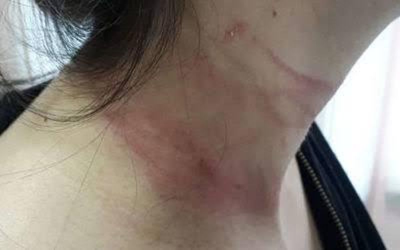 Ex-marido inconformado invade residência e tenta matar mulher estrangulada Ex-marido inconformado invade residência e tenta matar mulher estrangulada