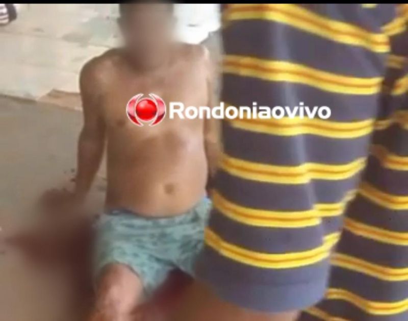 Idoso quase tem perna amputada a golpes de facão após briga em bar Idoso quase tem perna amputada a golpes de facão após briga em bar