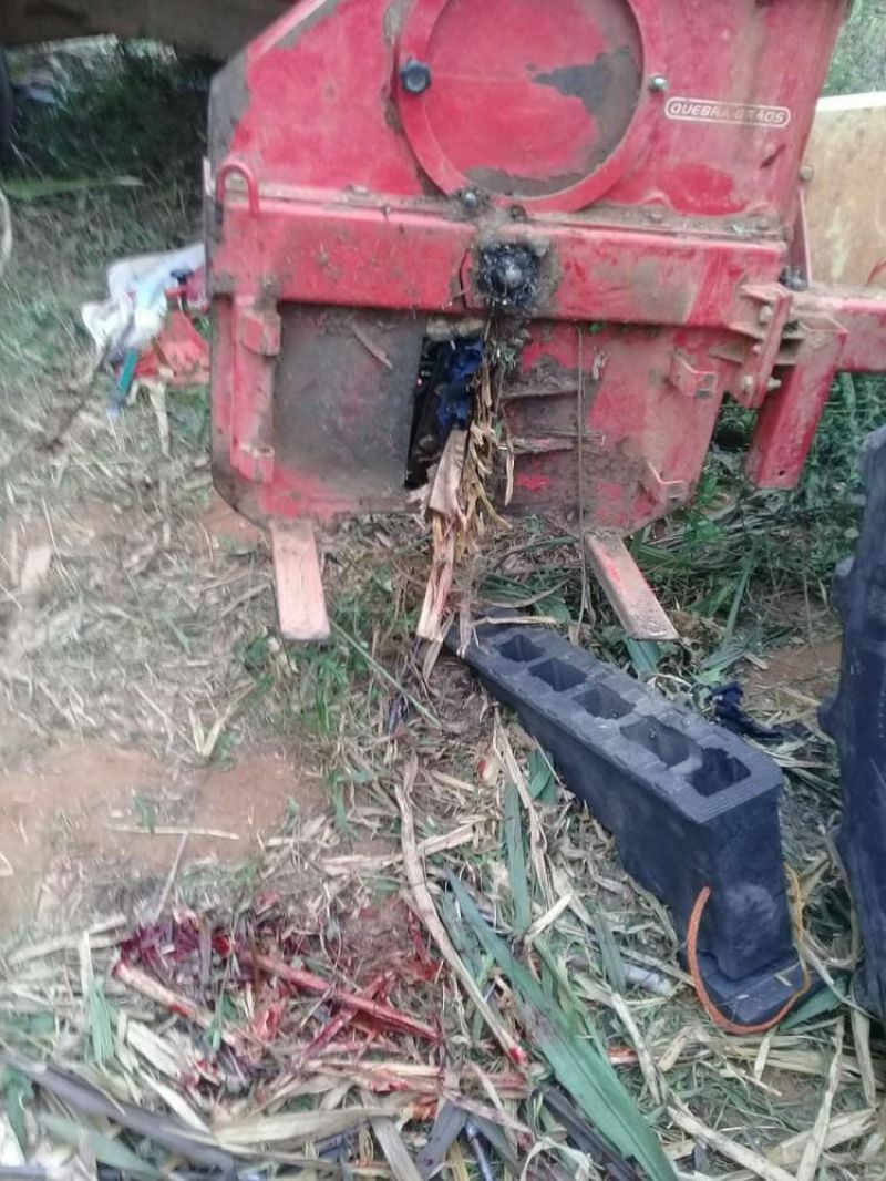 Jovem tem parte da perna arrancada em acidente de trabalho na zona rural de Jaru Jovem tem parte da perna arrancada em acidente de trabalho na zona rural de Jaru