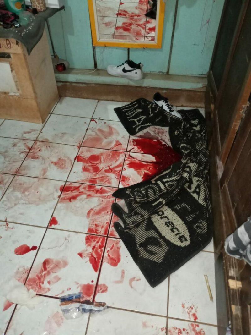 Ex-marido invade residência e atira na cabeça de mulher em Rolim de Moura