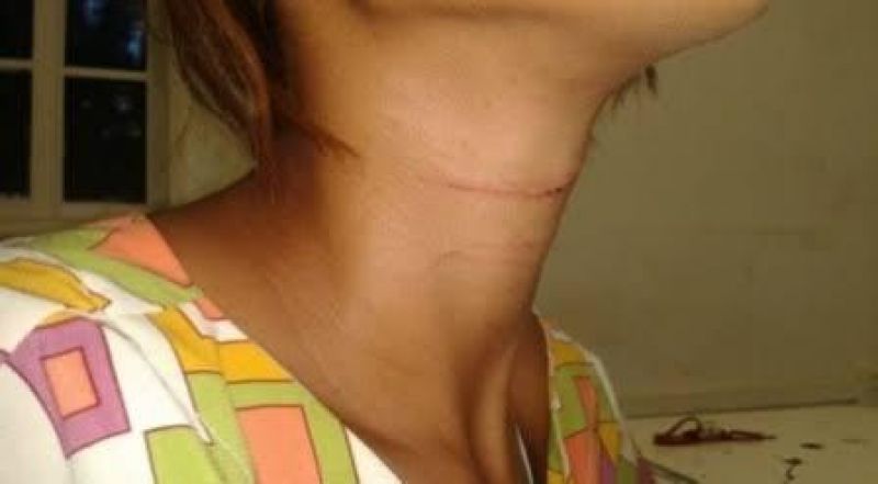 Marido é preso por agredir e ameaçar matar esposa com facada no pescoço Marido é preso por agredir e ameaçar matar esposa com facada no pescoço