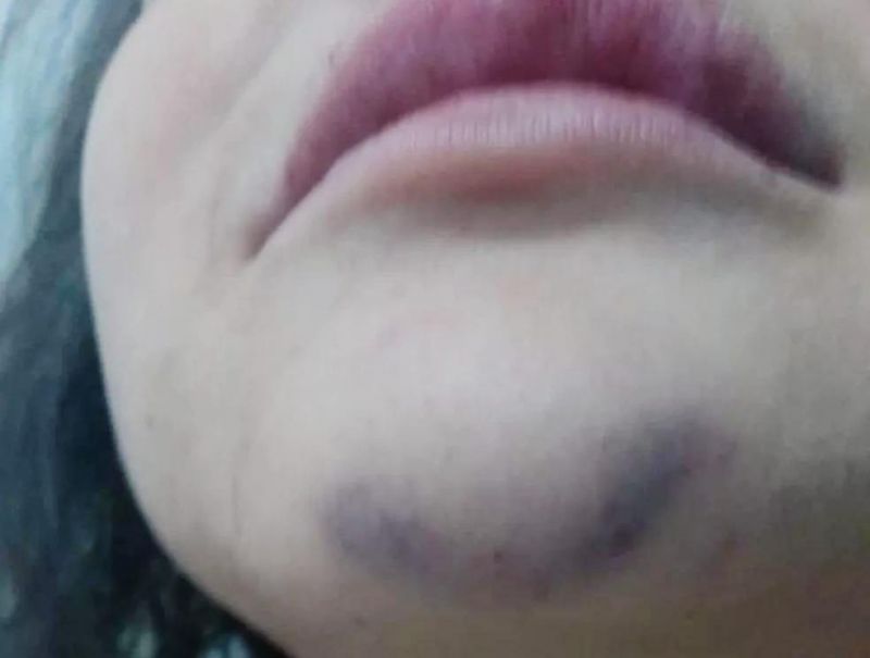 Mãe é agredida com socos no rosto pelo filho por causa de certidão de nascimento Mãe é agredida com socos no rosto pelo filho por causa de certidão de nascimento