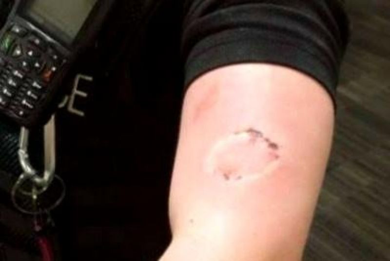 Mulher é acusada de atacar vizinhos a tesourada e morder policiais militares Mulher é acusada de atacar vizinhos a tesourada e morder policiais militares