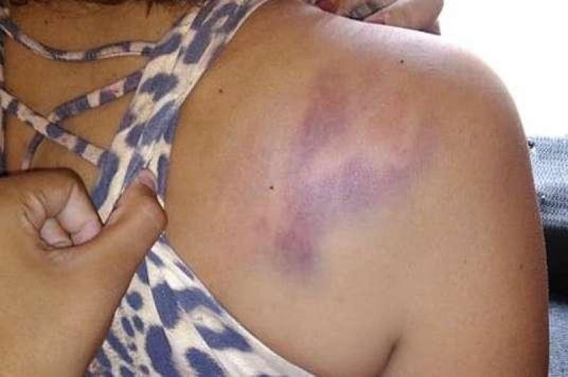 Mulher é agredida pelo marido ao chegar em casa de madrugada Mulher é agredida pelo marido ao chegar em casa de madrugada