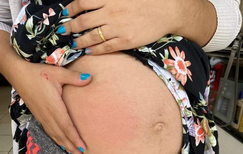 ATAQUE DE FÚRIA: Sogra entra na briga de casal e espanca a nora grávida ATAQUE DE FÚRIA: Sogra entra na briga de casal e espanca a nora grávida