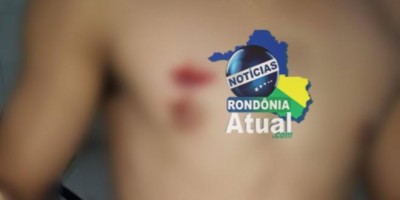 Ji-Paraná: Homem leva tiro no peito do atual marido de sua ex-mulher