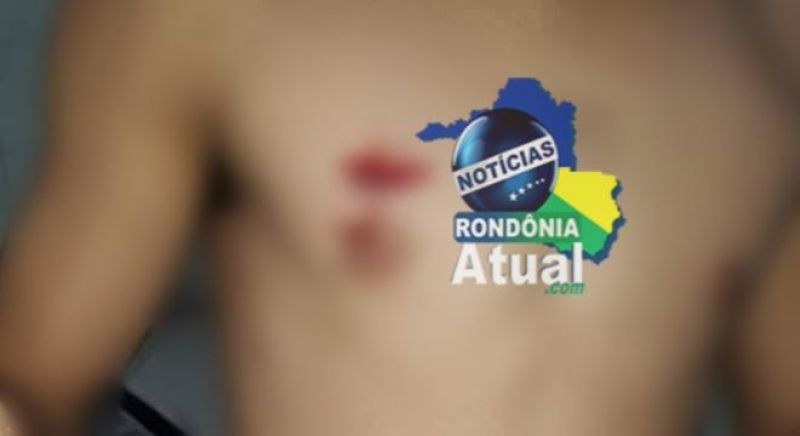 Ji-Paraná: Homem leva tiro no peito do atual marido de sua ex-mulher