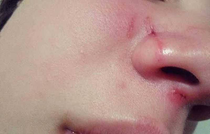 Marido violento quebra o nariz da esposa durante agressão por ciúmes Marido violento quebra o nariz da esposa durante agressão por ciúmes