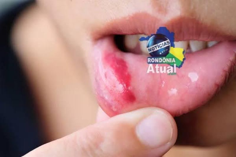 JI-PARANÁ: MARIDO ACUSA ESPOSA DE ESTAR DE TRELELÉ COM OUTRO, E SOCA A BOCA DELA JI-PARANÁ: MARIDO ACUSA ESPOSA DE ESTAR DE TRELELÉ COM OUTRO, E SOCA A BOCA DELA