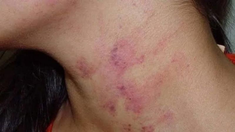 Mulher é agredida pelo marido, tenta evitar prisão dele, mas filhos denunciam Mulher é agredida pelo marido, tenta evitar prisão dele, mas filhos denunciam