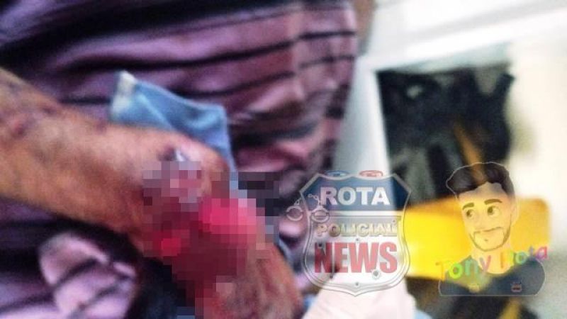 Idoso tem a mão dilacerada e sofre fratura exposta após ataque do próprio pitbull em Vilhena Idoso tem a mão dilacerada e sofre fratura exposta após ataque do próprio pitbull em Vilhena