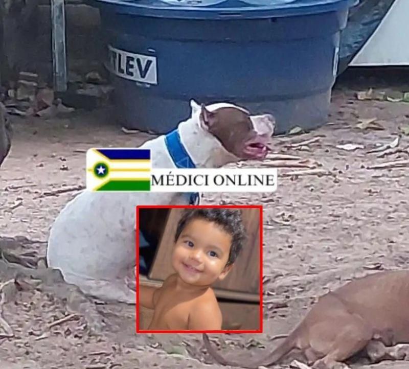 Criança de 1 ano e 4 meses morreu após ataque de Pitbull, em Presidente Médici Criança de 1 ano e 4 meses morreu após ataque de Pitbull, em Presidente Médici