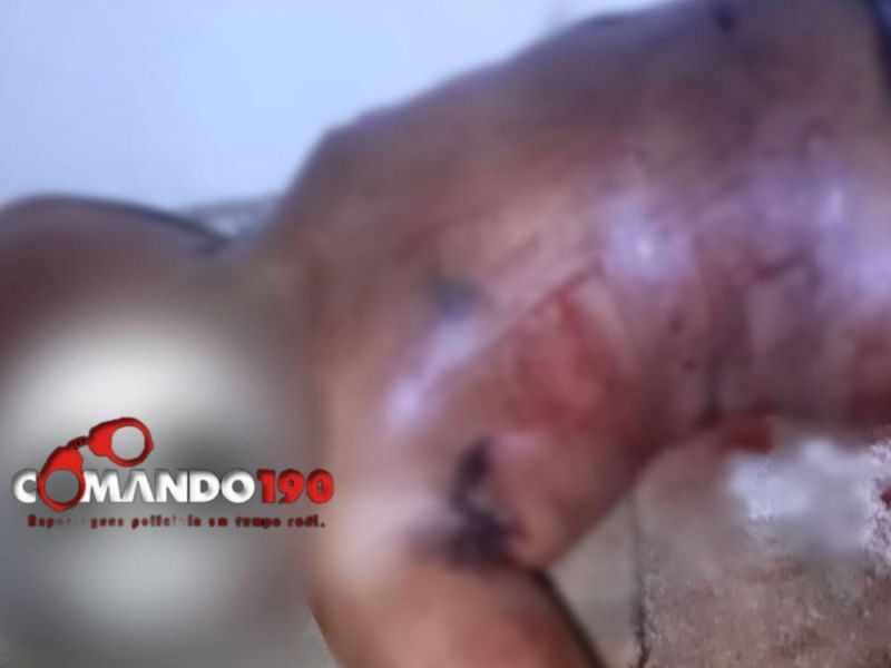 Discussão em propriedade rural termina com jovem esfaqueado em Ji-Paraná Discussão em propriedade rural termina com jovem esfaqueado em Ji-Paraná