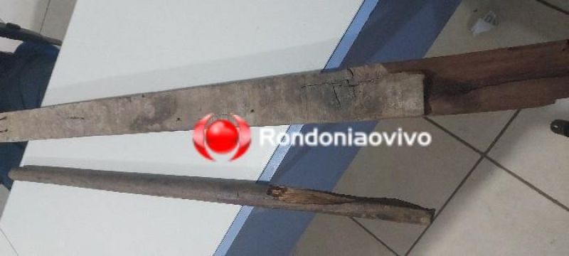 Mulher é espancada por dupla por dívida de R$ 100; Vítima teve perna e braço quebrados Mulher é espancada por dupla por dívida de R$ 100; Vítima teve perna e braço quebrados