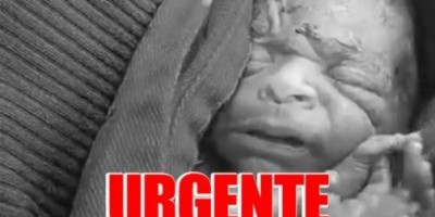 NÃO SUPORTOU: Bebê que 'ressuscitou' após ser declarado morto não resiste  NÃO SUPORTOU: Bebê que 'ressuscitou' após ser declarado morto não resiste