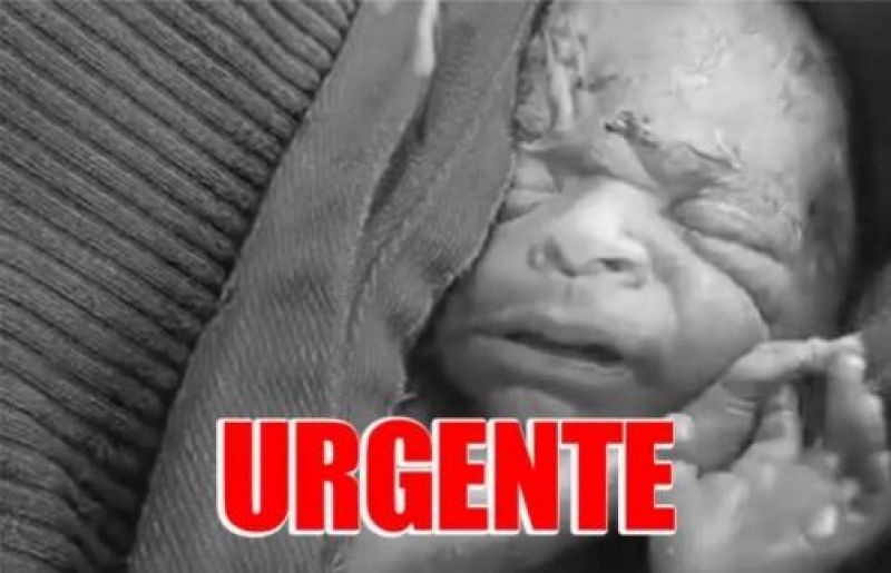 NÃO SUPORTOU: Bebê que  NÃO SUPORTOU: Bebê que