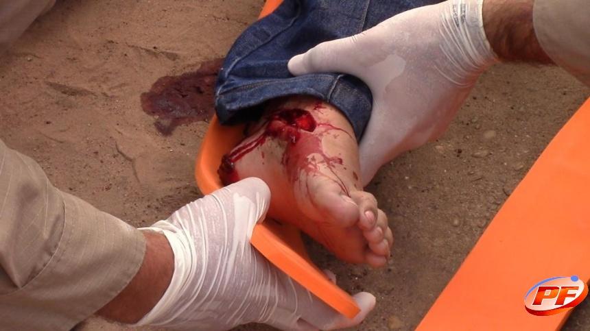 Garota é socorrida com ferimentos ao hospital após acidente entre motocicleta e carro no centro de Rolim de Moura