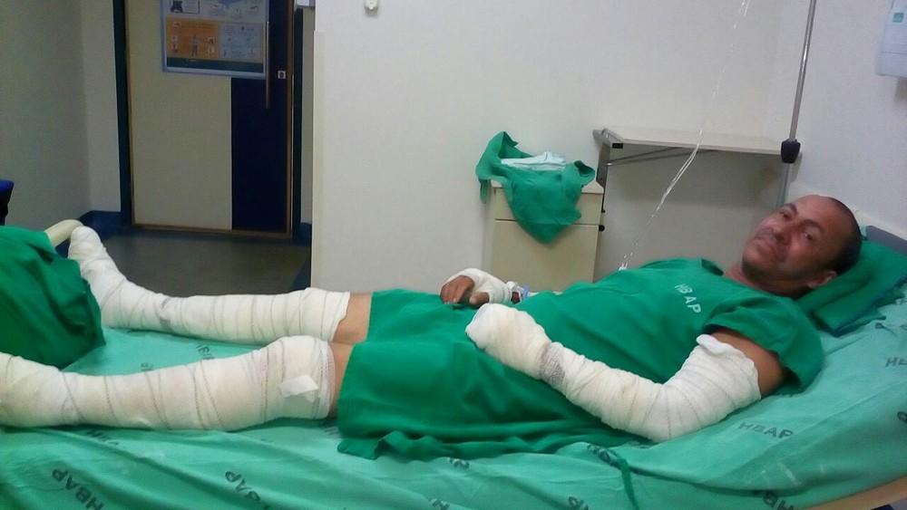 Menino de 3 anos que caiu dentro de fosso em chamas em RO recebe alta; pai continua internado